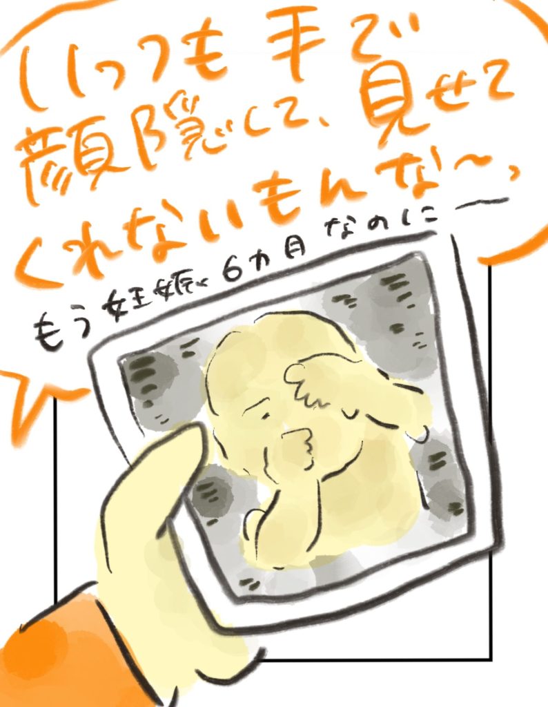 manga-cleft-lip-and-palate-01-05